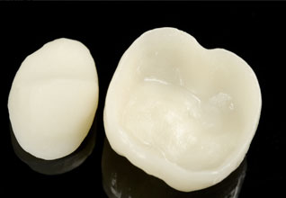 dental-makeovers